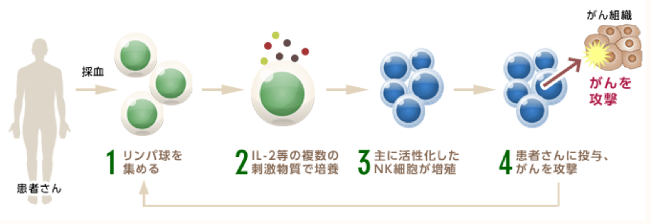 NK細胞療法