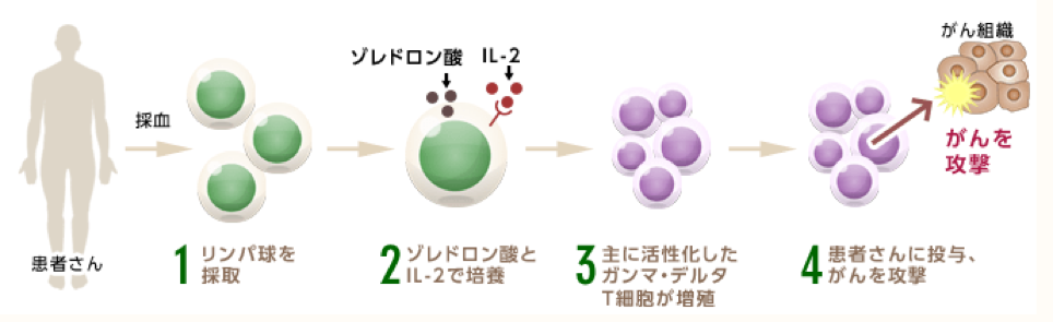 ガンマ・デルタT細胞療法（γδT細胞療法）